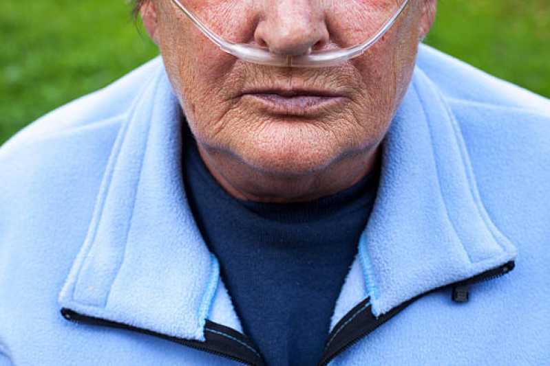 Onde Fazer Tratamento de Oxigenoterapia Domiciliar Guará - Tratamento de Oxigenoterapia por Cateter Nasal
